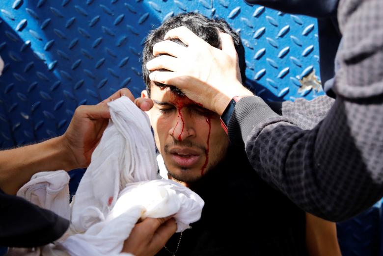 An injured demonstrator is helped by others during clashes with riot security forces during a strike called to protest against Venezuelan President Nicolas Maduro